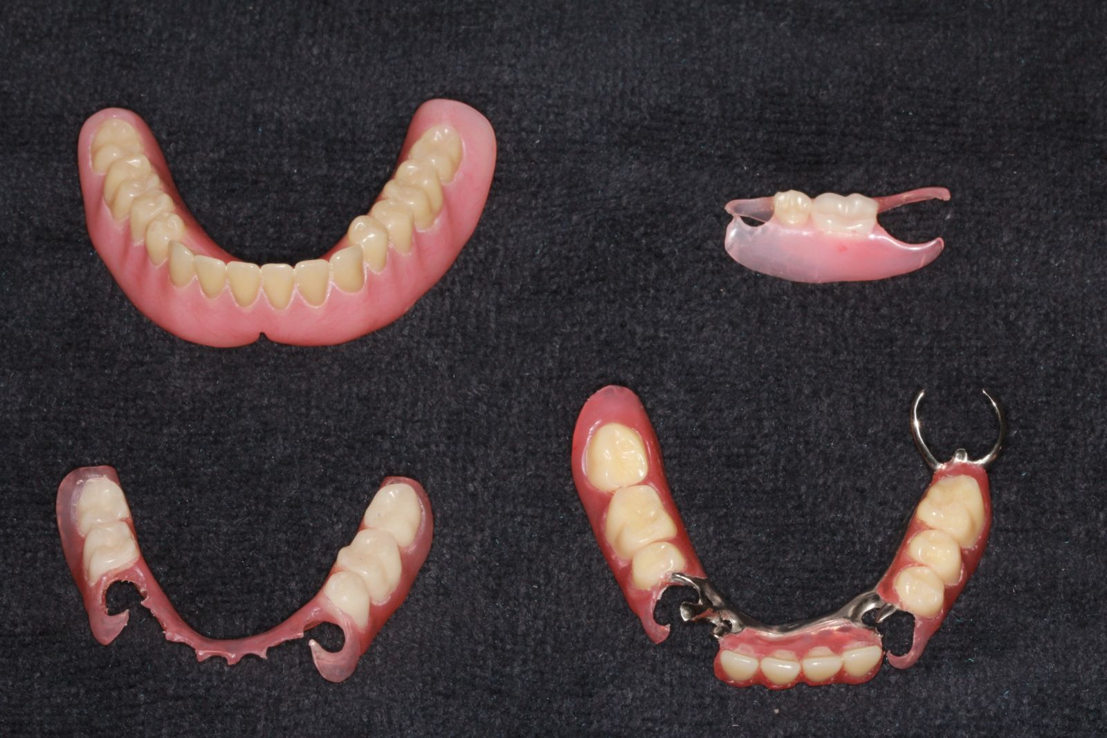 affordable dentures available in Frederick MD